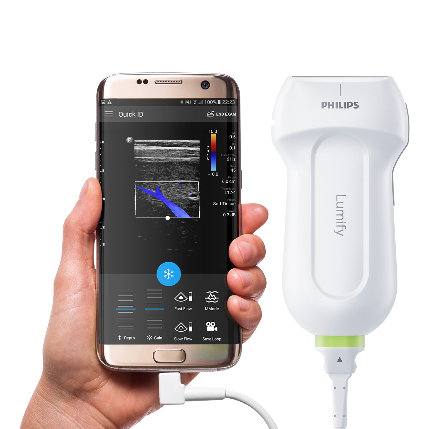 Philips Lumify – kompletne USG w smartfonie!