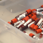 Niewielki odsetek Polaków robi testy na HIV. Wirus może pozostawać w uśpieniu nawet 10 lat